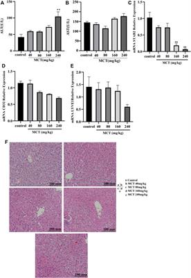 Expression profiles of lncRNAs and their possible regulatory role in monocrotaline-induced HSOS in rats